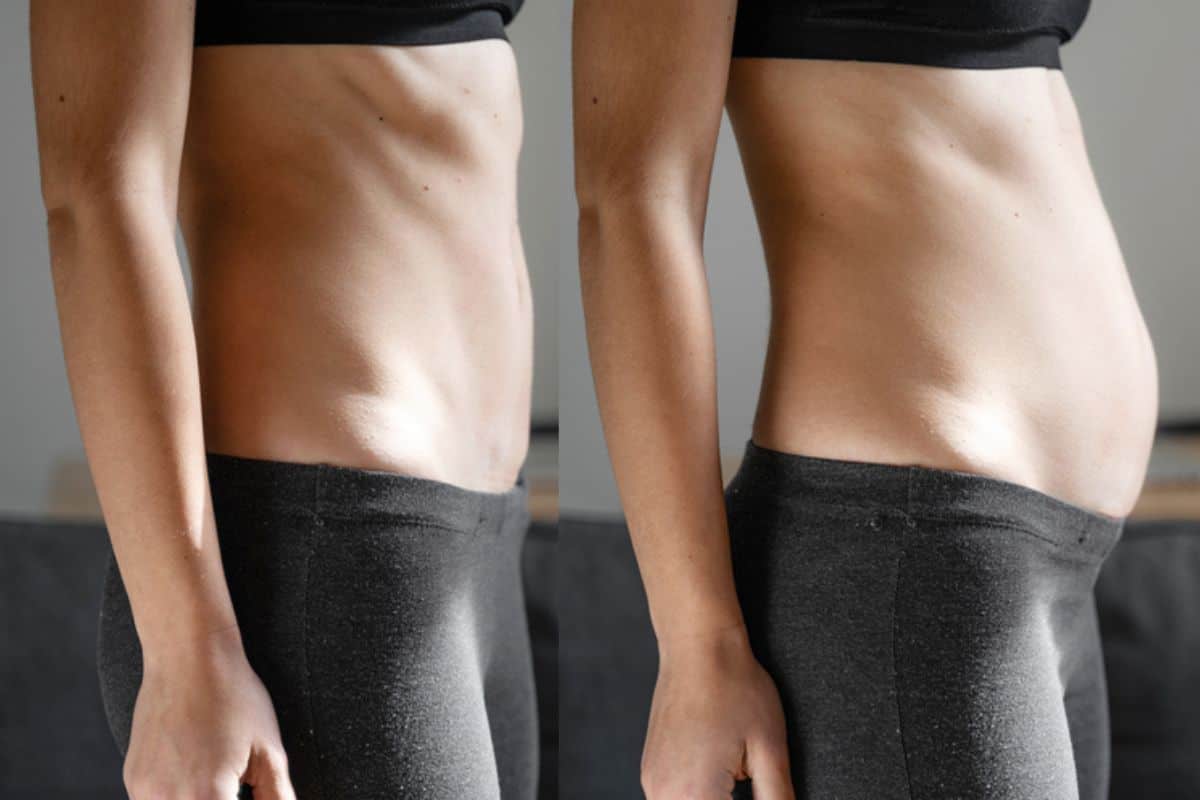 How long does diastasis recti take to improve Leyton Marshes?