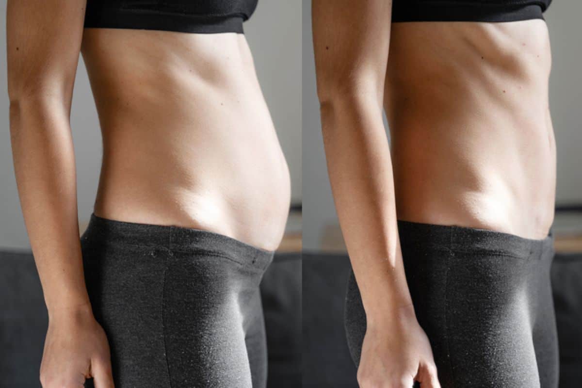 Post-Pregnancy: What Happens to Your Abdominal Muscles After Birth Leyton Marshes