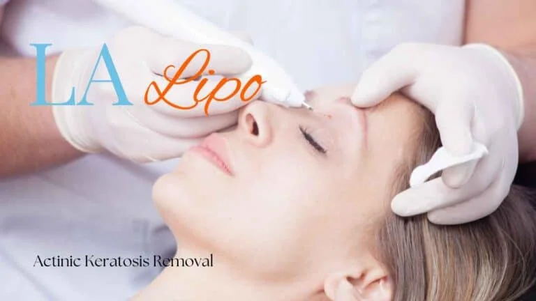 Woman receiving Actinic Keratosis Removal Treatment Leyton Marshes