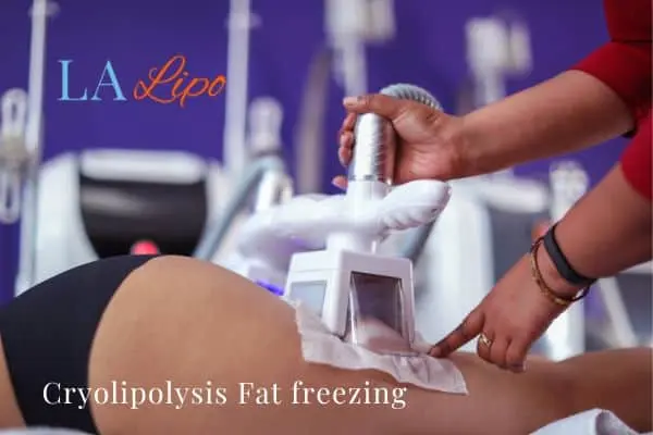 women getting fat freezing Leyton Marshes