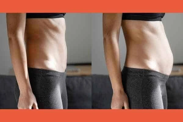 LA-EMS Body Sculpting results Leyton Marshes