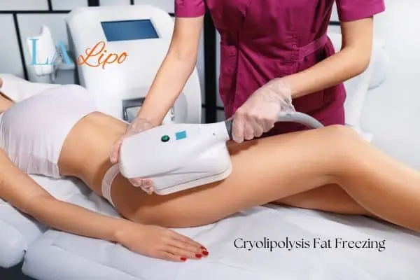 Woman receiving coolsculpting Leyton Marshes treatment on her thighs
