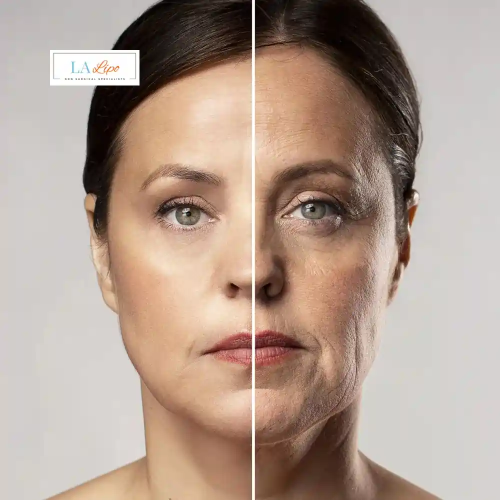 How Can You Tell If Non-Surgical Skin Tightening Is Right for You Leyton Marshes?